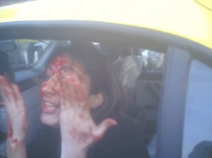 women-in-iran Tina Rad beaten in Iran by police for not covering her face etc.